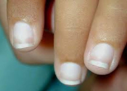 бледные ногти 