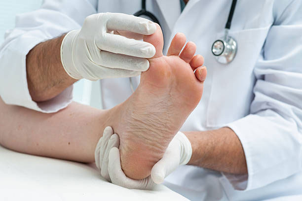 предотвращение распространения грибка ногтей на ногах