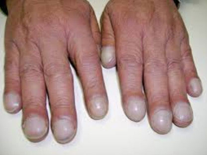 клубные ногти