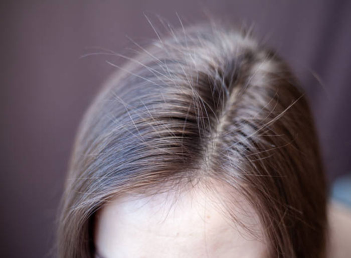 средство против выпадения волос